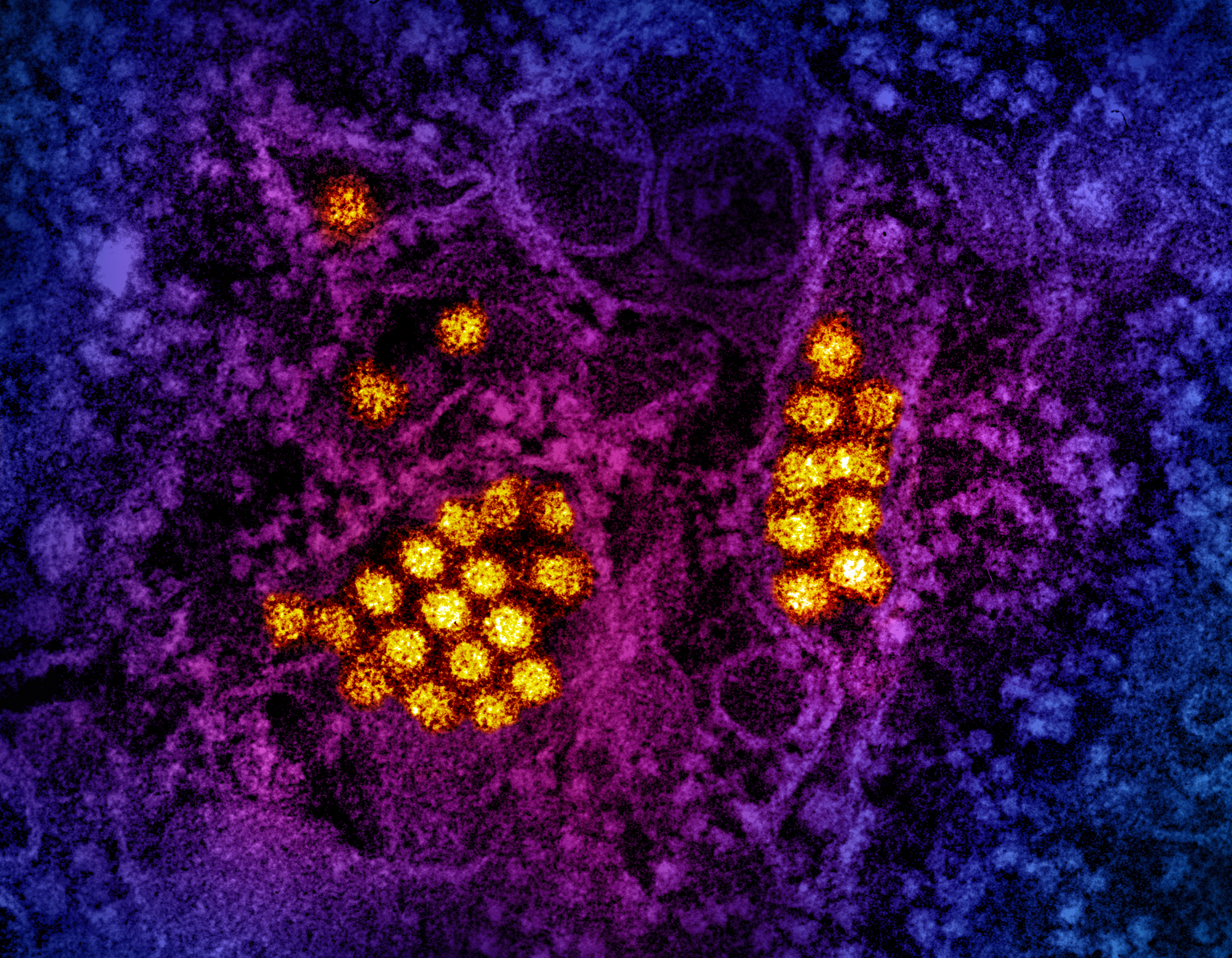 BARDA Announces SMART Antiviral Prize Concept Stage Winners, Expands…